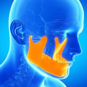 TMJ THERAPY