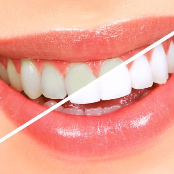North View Dental Dentist North Ogden Utah