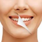 SMILE MAKEOVERS