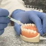 NO DRILL DENTISTRY