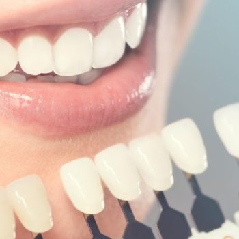 North View Dental Cosmetic Dentistry North Ogden Utah