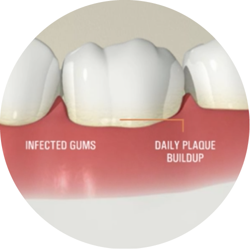 Home North View Dental Cleaning North Ogden Utah