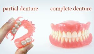 Dentures (False Teeth) false teeth complete partial