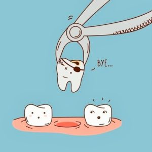 Tooth Extraction Aftercare (Healing Tips) tooth extraction aftercare comic