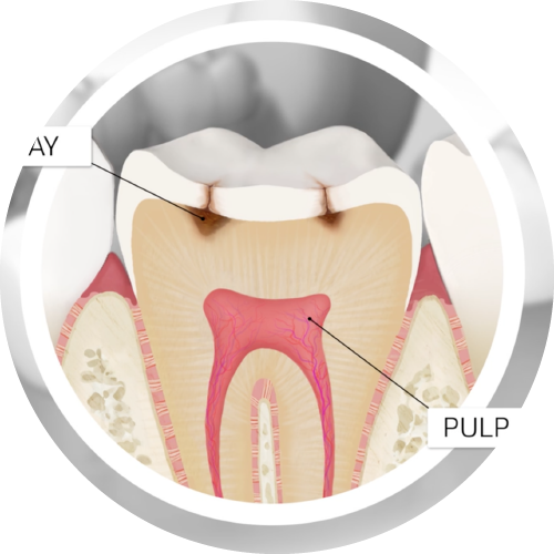 Home North View Dental Filling North Ogden Utah