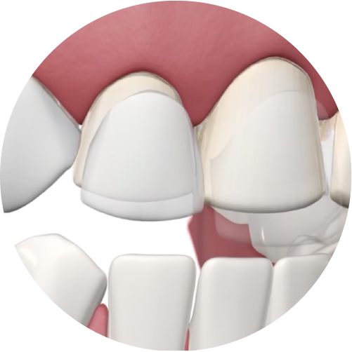 Cosmetic Dentistry North View Dental Utah
