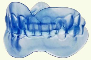 Snore Therapy (Snoring Solutions) snoring solutions mouth guard