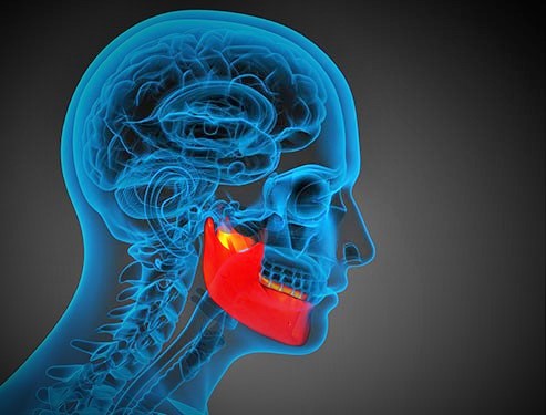 TMJ Pain Relief