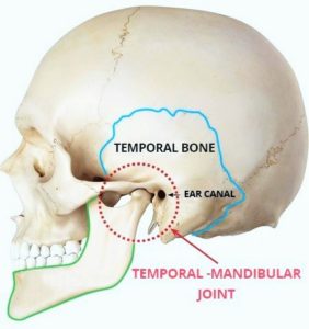 Tmj Pain Relief TMJ Pain Relief diagram