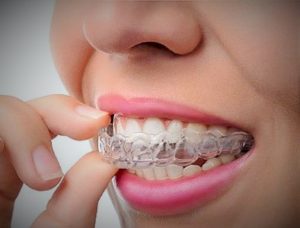 How A Dental Night Guard Aids In Sleep dental night guard sleep aid