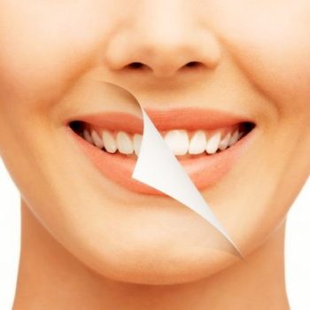 North View Dental Smile North Ogden Utah