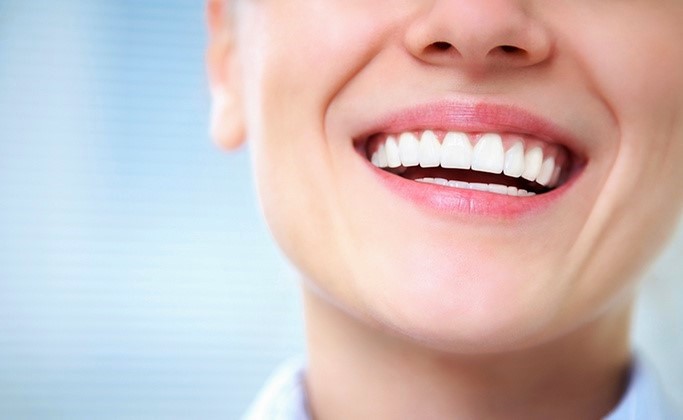 How A Smile Makeover Boosts Confidence Smile Makeover Confidence