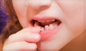 What To Do When Your Child Is Afraid Of Losing Baby Teeth losing baby teeth child fears