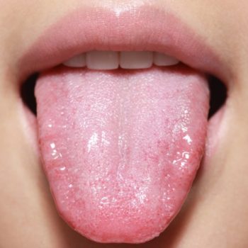North View Dental Tongue North Ogden Utah