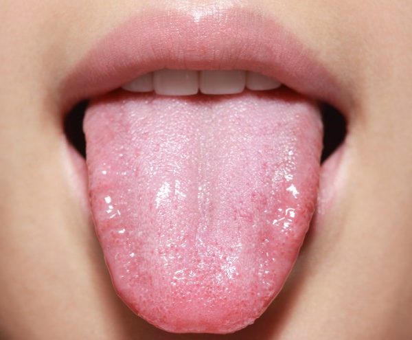North View Dental Tongue North Ogden Utah