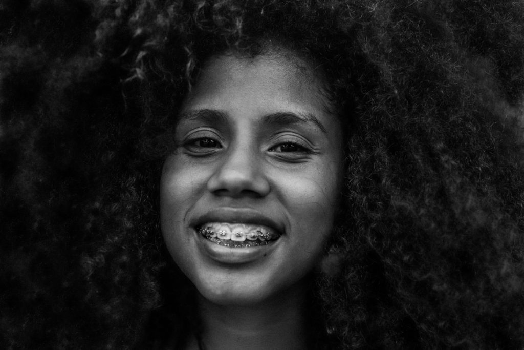 Clear vs Traditional Braces