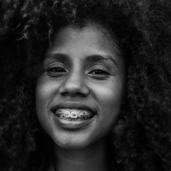 North View Dental Braces North Ogden Utah