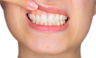 4 Reasons For Gums Bleeding While Flossing gums bleeding, Ogden