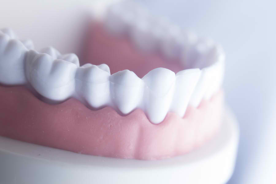 How to Keep Your Gums Healthy