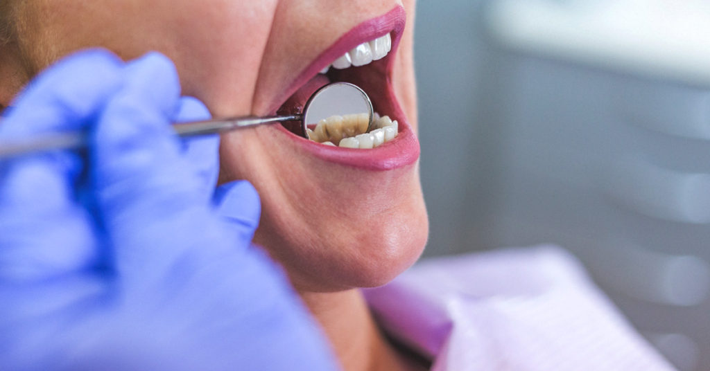 Signs Of Tooth Infection