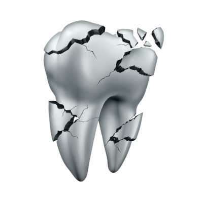 Why You Need To Replace A Missing Tooth Why You Need to Replace a Missing Tooth