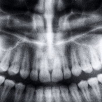North View Dental Tooth X-Rays North Ogden Utah