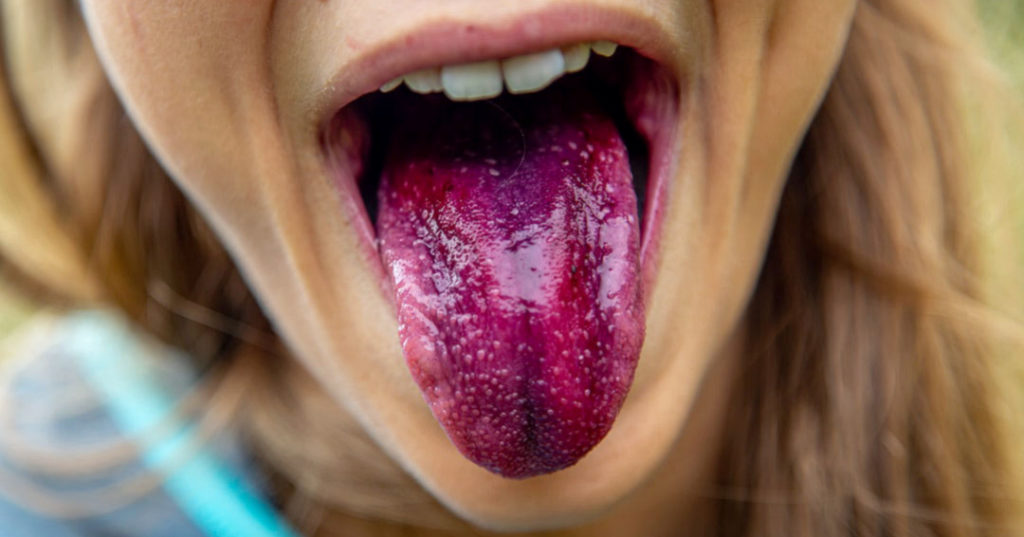 Why You Should Brush Your Tongue