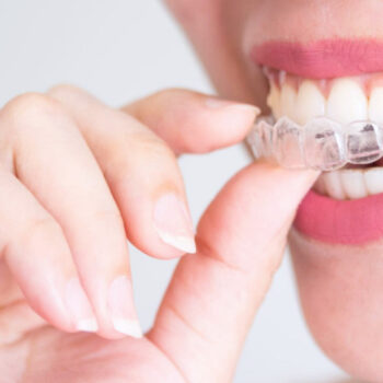 North View Dental Invisalign North Ogden Utah