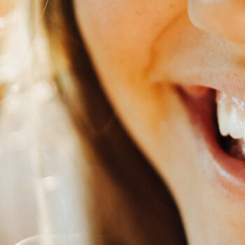North View Dental whitening teeth North Ogden Utah