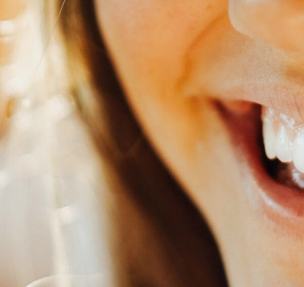 North View Dental whitening teeth North Ogden Utah