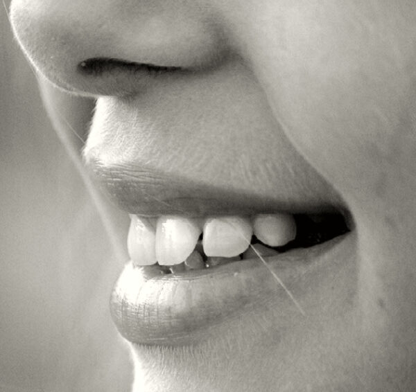 North View Dental Cracked Tooth North Ogden Utah