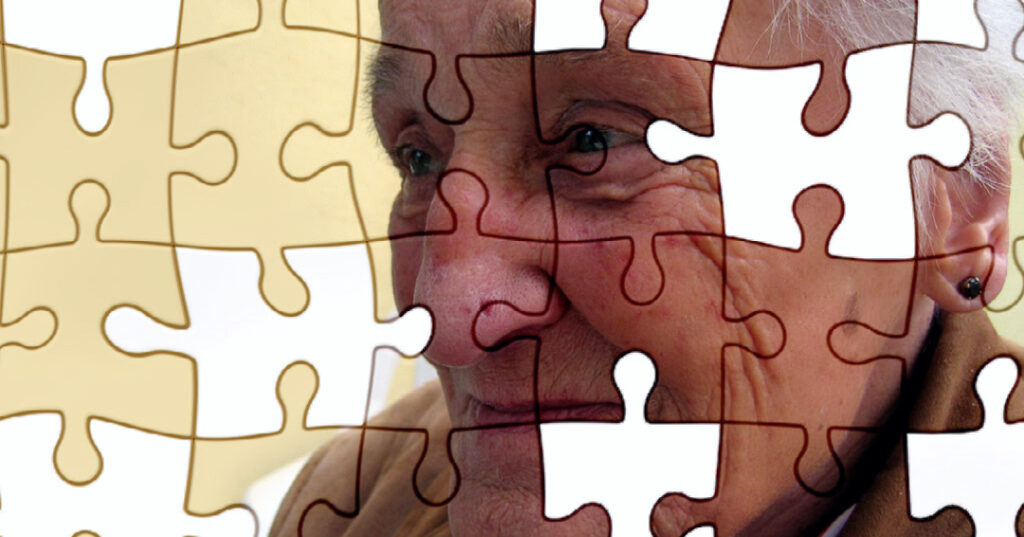 Alzheimer’s and Dental Health