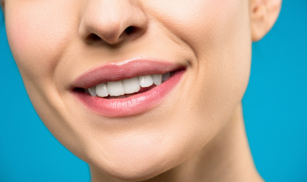 What Veneers Can Do For You North View Dental Utah