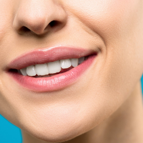 North View Dental Veneers North Ogden Utah