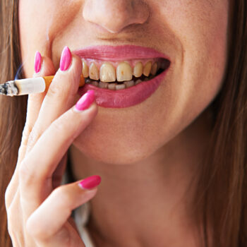 North View Dental Oral Health North Ogden, Utah