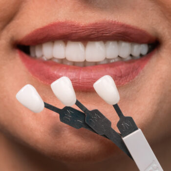 North View Dental Veneers North Ogden, Utah