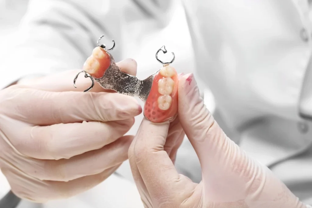 Should You Get An Implant-Supported Dental Bridge? Implant-Supported Bridge - North View Dental, North Ogden, Utah