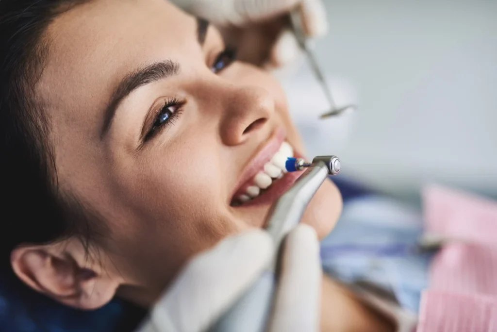 Can You Remove Dental Calculus At Home? 