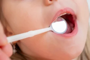 Is It Safe To Pull A Loose Baby Tooth? Loose Baby Tooth - North Ogden, UT