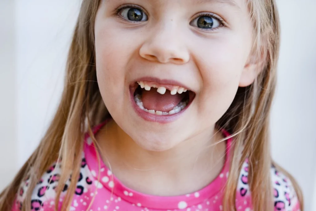 Is It Safe to Pull a Loose Baby Tooth?