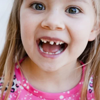 Loose Baby Tooth - North Ogden, UT