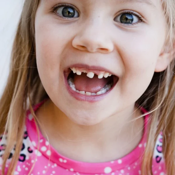Loose Baby Tooth - North Ogden, UT