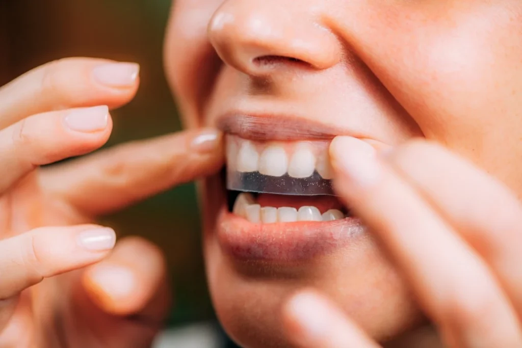 The Selfie-Ready Smile: Why Professional Whitening Beats the Box