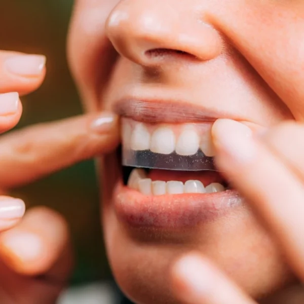 Professional Whitening - North Ogden, UT